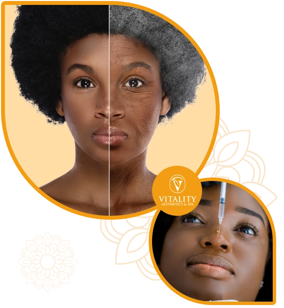 https://vitalityaestheticslagos.com/wp-content/uploads/2025/06/Lagos-girl-botox-treatment.webp
