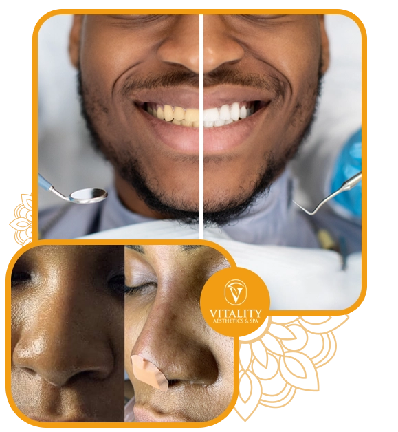 https://vitalityaestheticslagos.com/wp-content/uploads/2025/06/Lagos-man-botox.webp